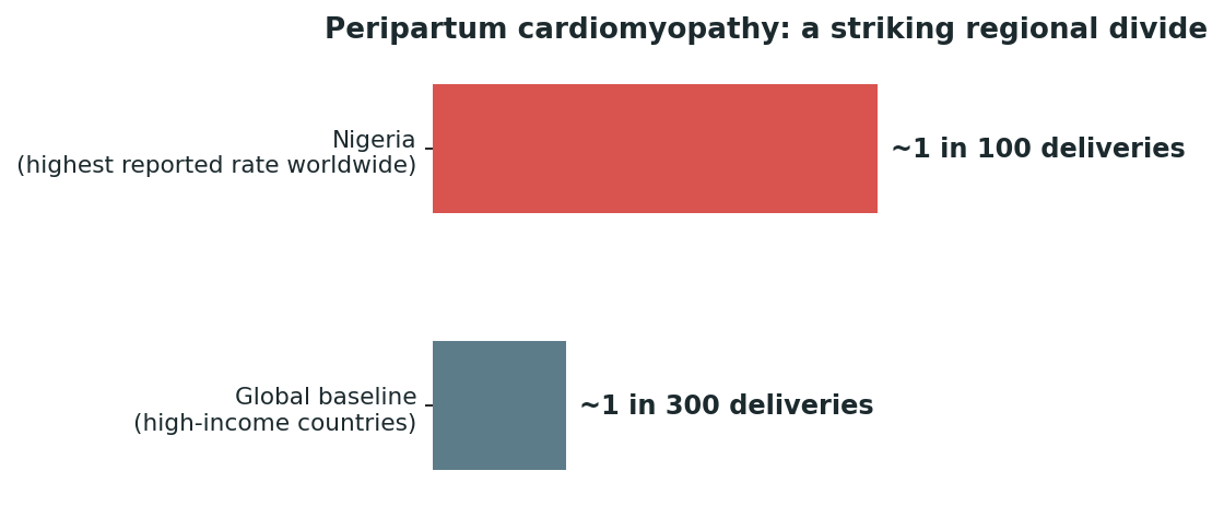 Chart: The Somali difference: a young mother's breathlessness deserves the same scrutiny as any other heart symptom