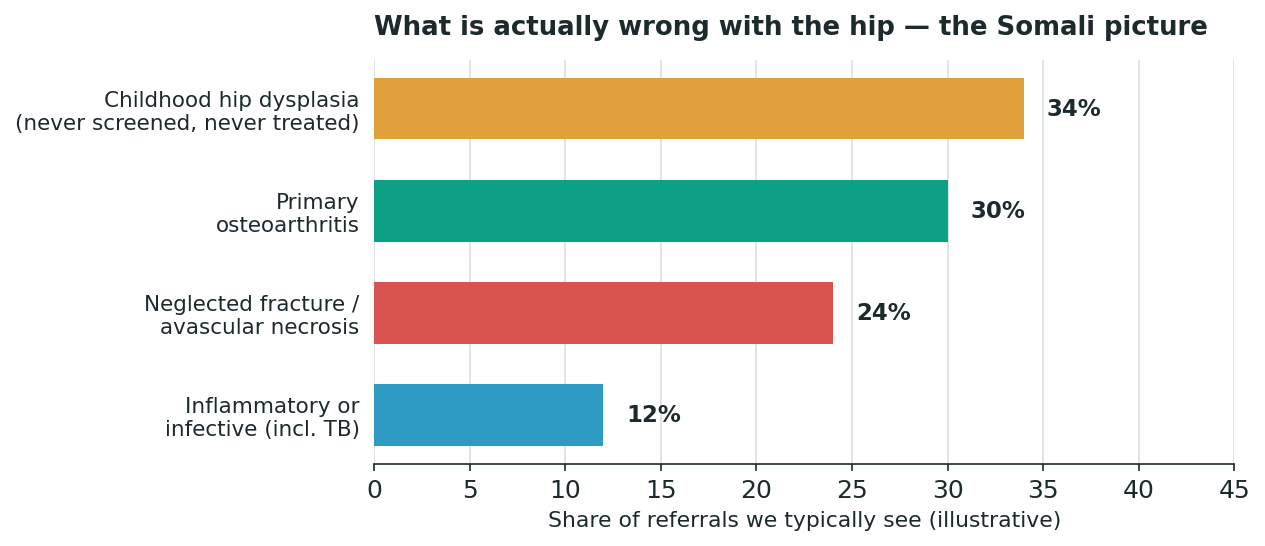 Chart: First, name what actually destroyed the hip