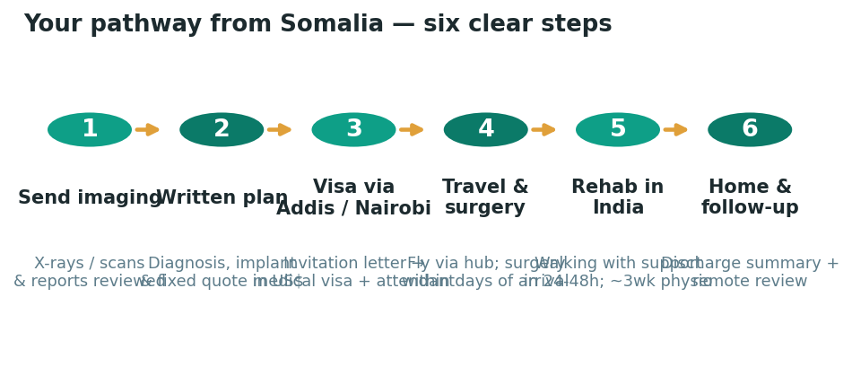 Chart: The practical journey from Somalia — plan it before you fly