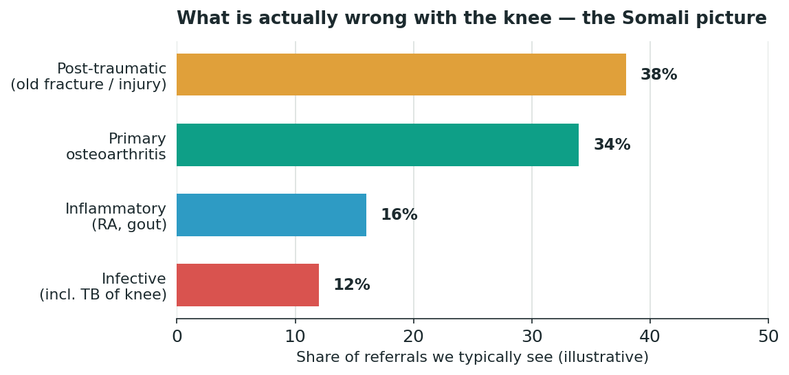 Chart: First, name what is actually wrong with the knee