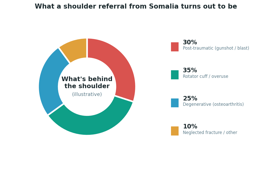 Chart: The Somali difference: trauma and overuse, both at unusually high rates