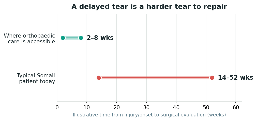 Chart: Why the delay changes the operation on the table