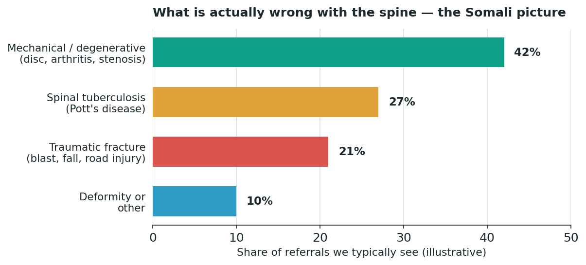 Chart: First, know what is actually wrong with the spine
