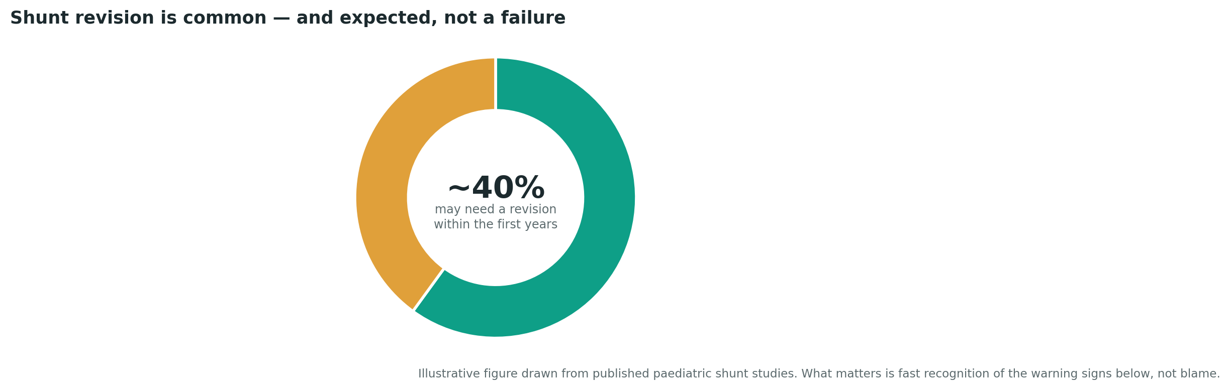 Chart: Knowledge that must come first: hydrocephalus, shunts, and why revision is normal, not failure