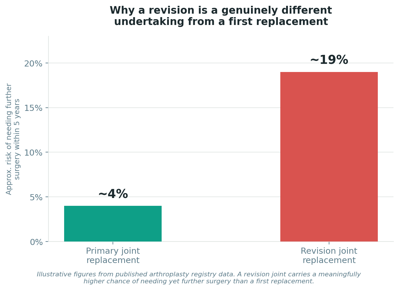 Chart: Why a revision is a genuinely different undertaking