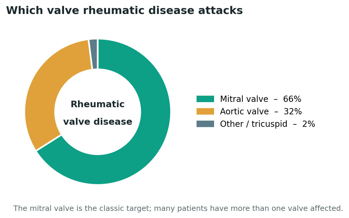 Chart: Knowledge first: which valve — and can it be saved?