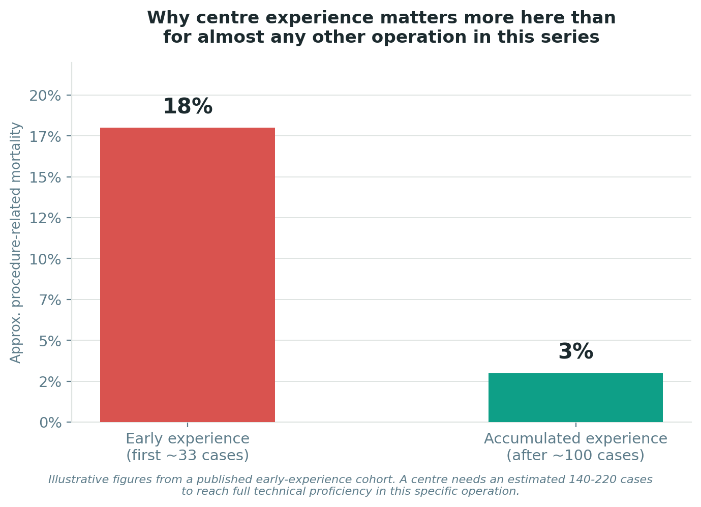 Chart: Why centre experience matters more here than almost anywhere else