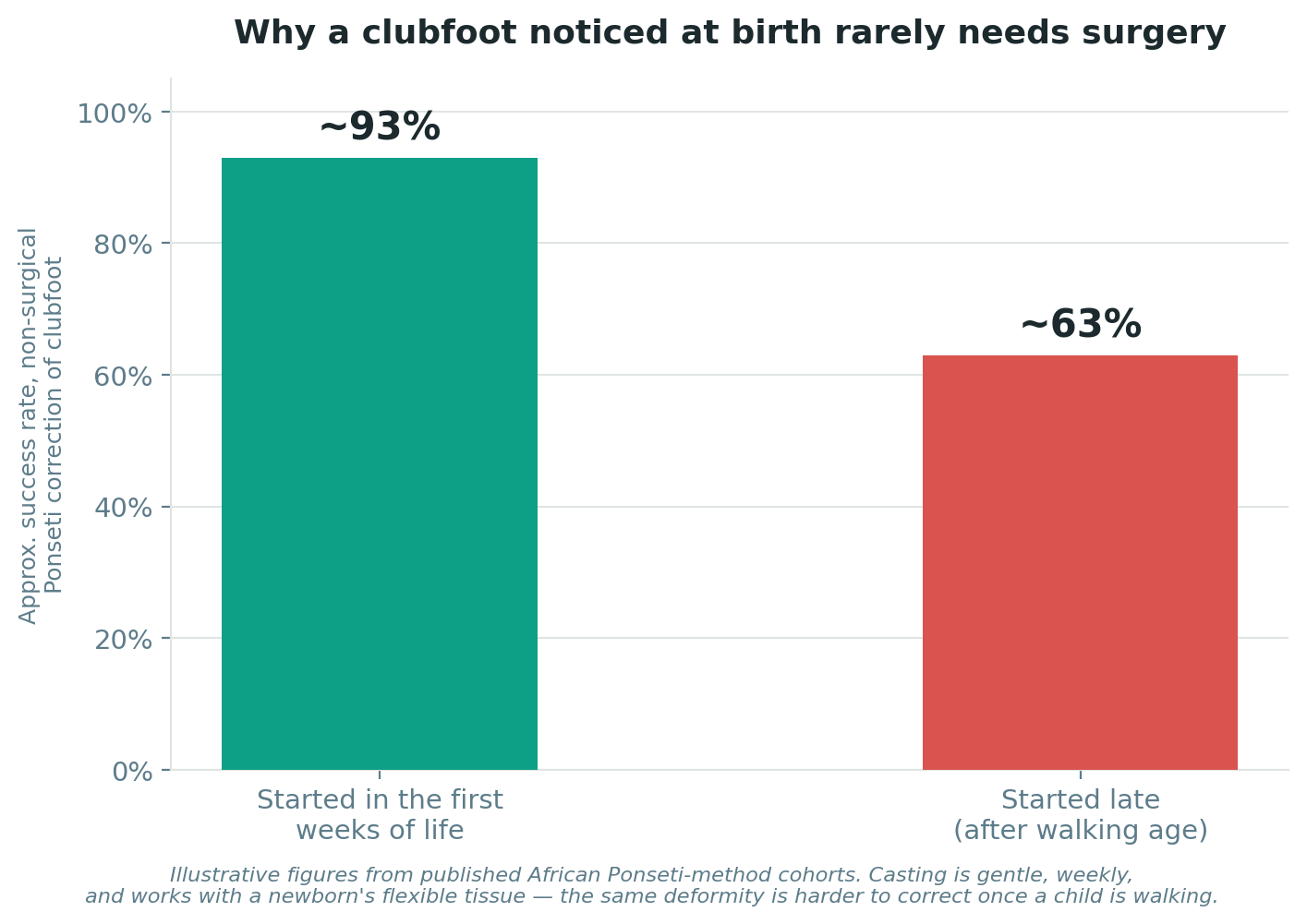 Chart: Clubfoot: a deformity best treated without surgery at all
