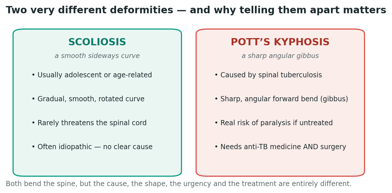 Chart: The two deformities this guide covers, and why they are different