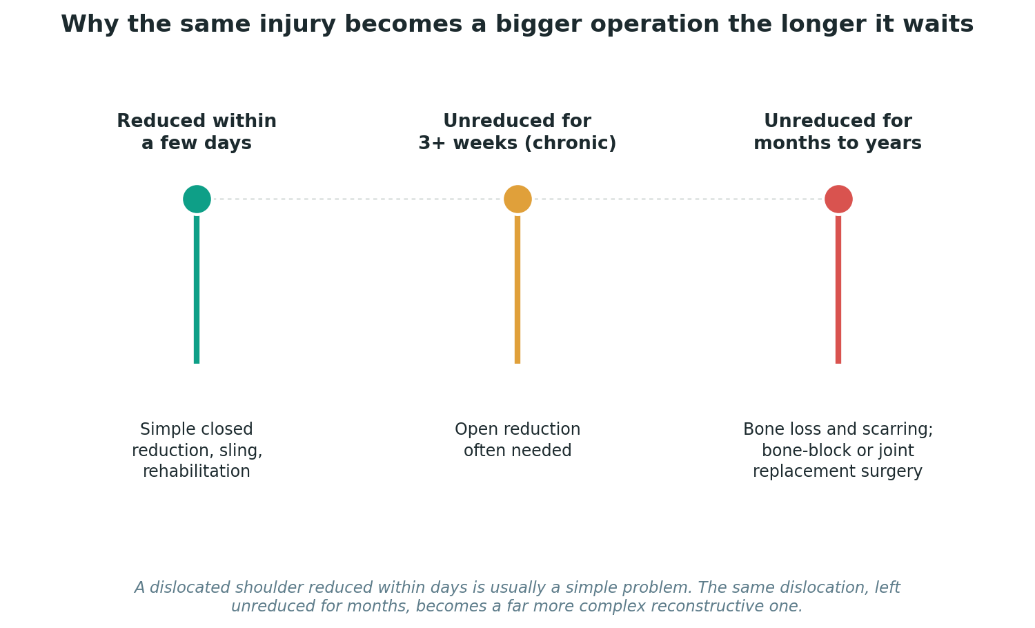Chart: Why time matters so much for a dislocated shoulder