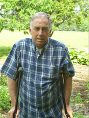 Testimonial of Knee Surgery India, Photos of Knee Surgery India, Testimonial of Knee Surgery Bangalore